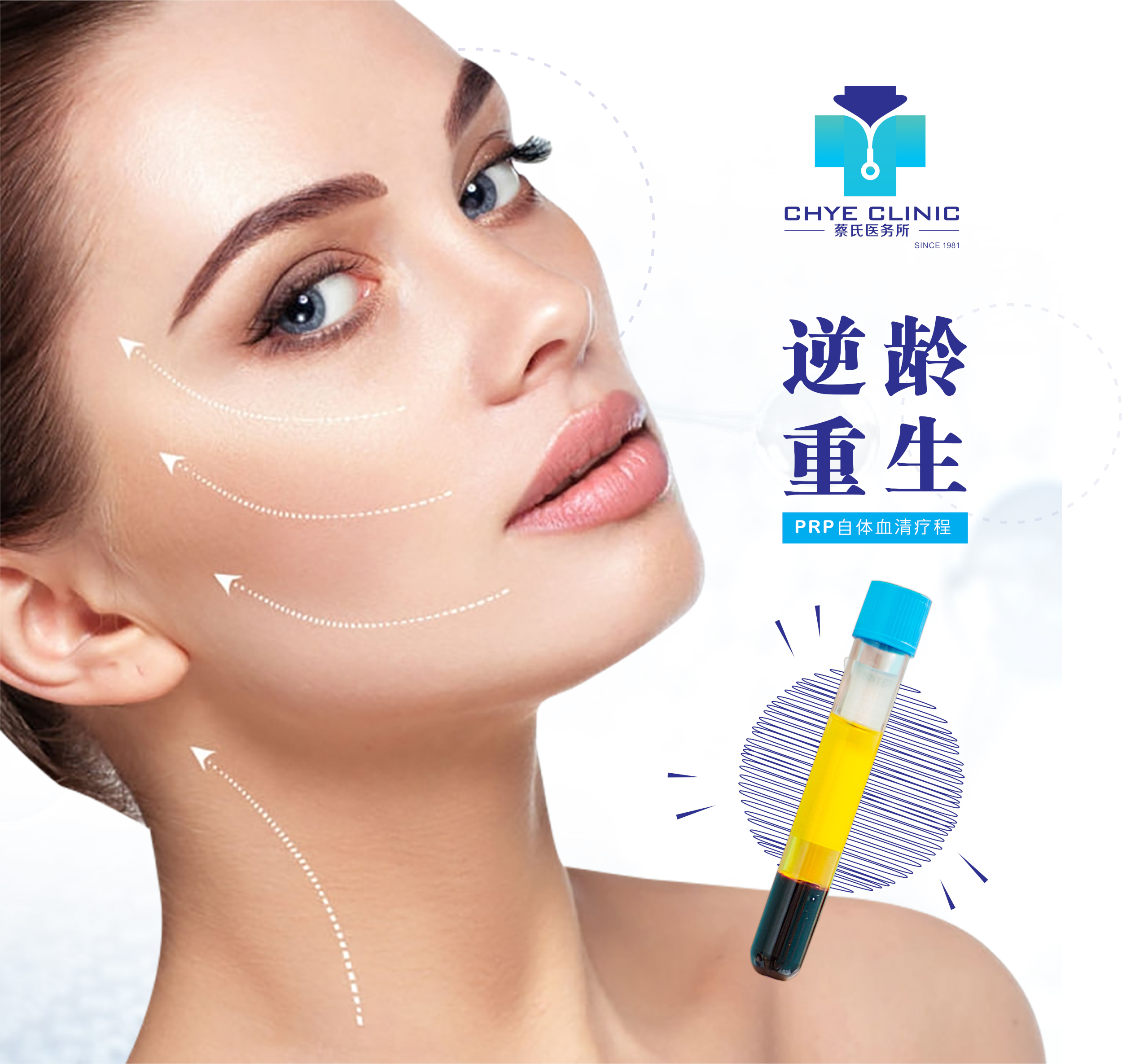 PRP face in KL Chye clinic