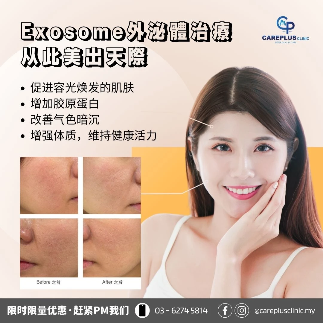 Exosome外泌體治療：从此美出天際！