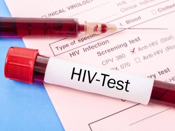 https://chyeclinic.com/std-screening-and-treatment-center-kepong/